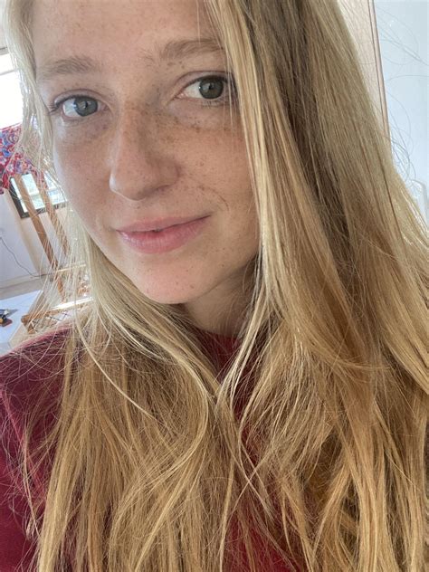 Freckle Lovers Unite 🌏🌍🌎 Rfreckledgirls