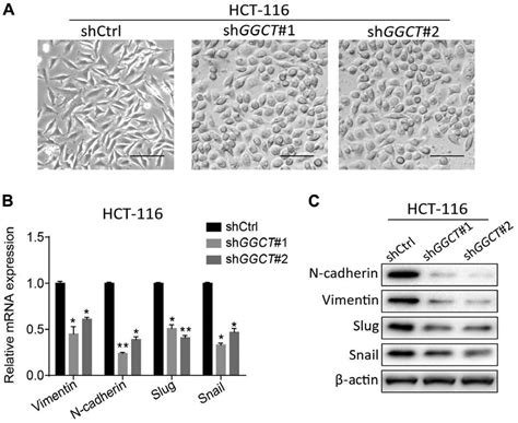 Disruption Of GGCT Inhibited The EMT Of HCT 116 Cells A