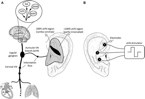 Vagus Nerve Stimulation