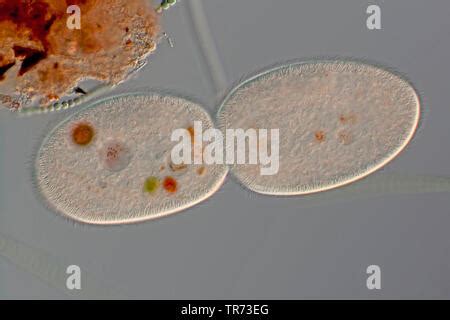 Ciliate Protozoen Differential Interferenz Kontrast DIC Aufnahme