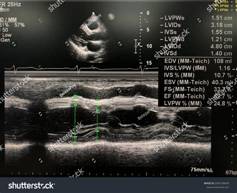 19 M Mode Echo Images, Stock Photos & Vectors | Shutterstock