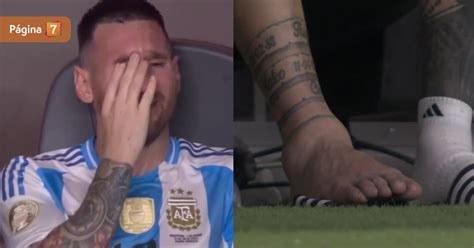 Así quedó el tobillo de Lionel Messi en final de Copa América