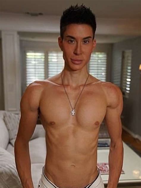 Justin Jedlica El Hombre Con Más De 500 Cirugías Plásticas En El