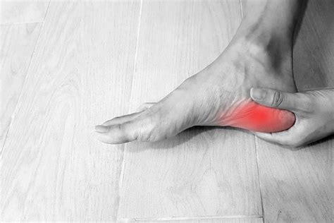 Heel pain | Plantar Fasciitis