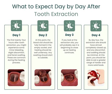 Tooth Extraction River Edge Tooth Removal In Westwood Englewood