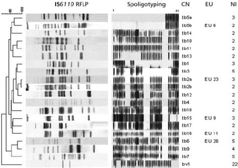 Dendrogram Based On The 20 Different IS 6110 RFLP Patterns Of The