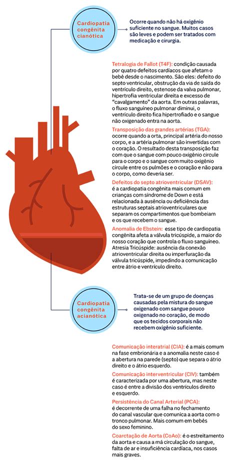 Cardiopatia Cong Nita O Que Sintomas E Tratamentos Nav Dasa