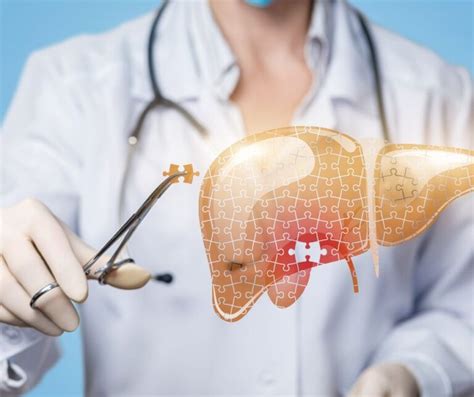 Radioembolizarea hepatică Dr Cezar Bețianu medic radiolog