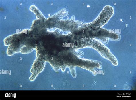 Protozoa Amoeba LM Stock Photo Royalty Free Image 134944374 Alamy