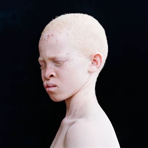 58 Albino People Wholl Mesmerize You With Their Otherworldly Beauty