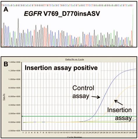 Figure 1 from A Comparison of EGFR Mutation Testing Methods in Lung ...