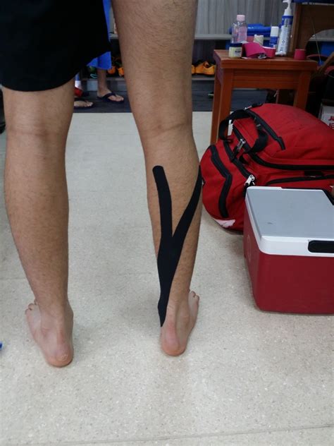 Effects Of Kinesio Taping Versus Mcconnell Taping For 49 Off