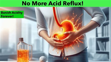 How To Get Rid Of Acidity Permanently Cure Acid Reflux Naturally