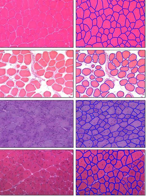 Segmentation Results On Four Sample H E Stained Skeletal Muscle Image