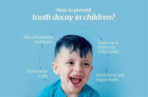 How to prevent tooth decay in children?