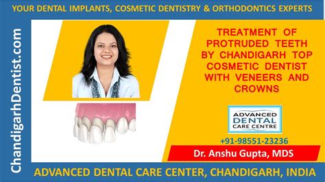 Chandigarh Best Cosmetic Dentist Treatment Of Protruded Teeth Without