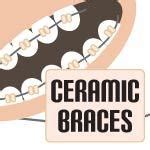 7 Tips to Prevent Ceramic Braces from Staining