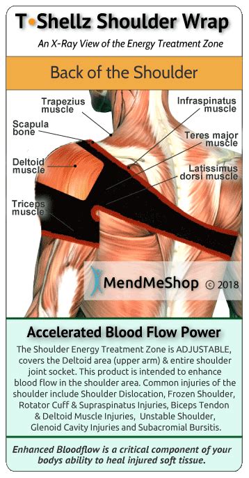 Deltoid Strain