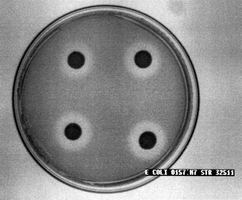 Spot Agar Assay Showing Zones Of Inhibition Of An E Coli O H