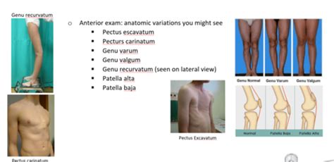 Osteopathic Structural Exam Flashcards Quizlet