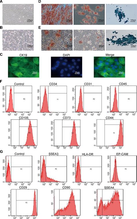 Characterization Of Hamscs Human Amniotic Mesenchymal Stem Cells And