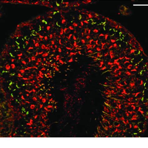 Confocal Laser Scanning Microscope Image Of Double Immunofluorescence