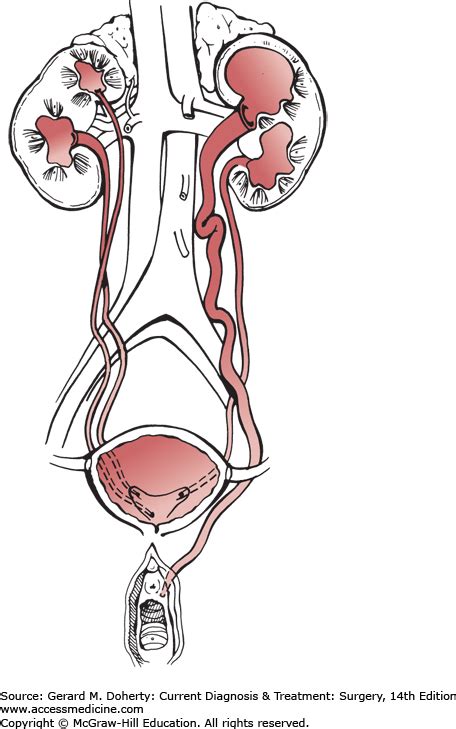 38 Urology Basicmedical Key