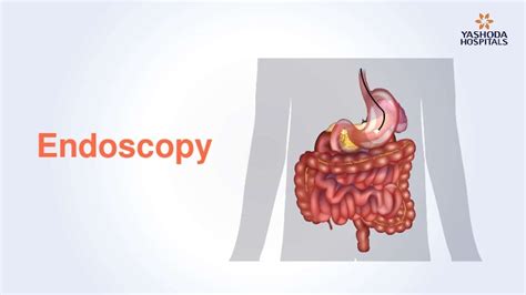 Endoscopy: Types, Preparation, Diagnosis, Procedure and Risks