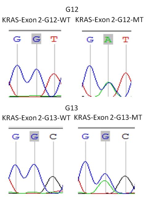 Kras Exon Primer Set Femtopath Hongjing