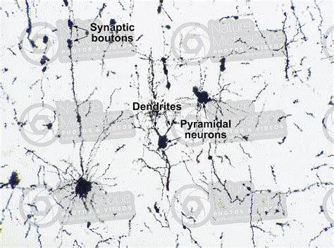 Mammal Cerebral Cortex Neuron Silver Stain X Neuron Mammals