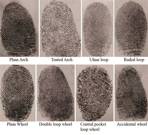 Ulnar Loop Vs Radial Loop Fingerprint