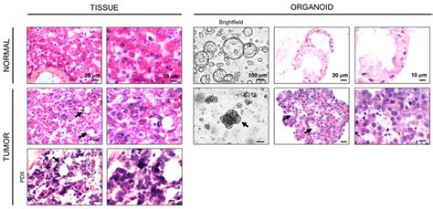 Representative Hematoxylin And Eosin Staining Of Normal And Tumor Download Scientific Diagram