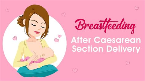 Breastfeeding After Cesarean Tips And Positions Atelier Yuwaciaojp