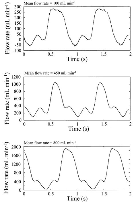 Flow Waveforms Obtained For Pulsatile Flow Experiments Download Scientific Diagram