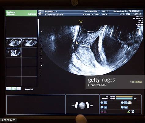 Ultrasound 8 Months Photos and Premium High Res Pictures - Getty Images