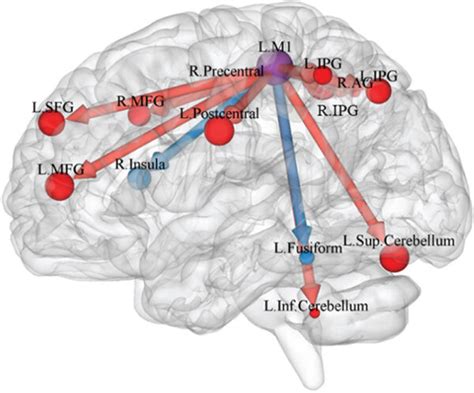 A Between Group Differences In Effective Connectivity From The Left