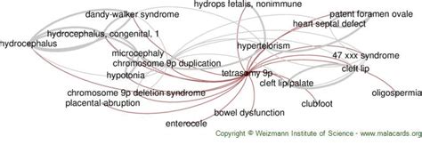 Tetrasomy 9p disease: Malacards - Research Articles, Drugs, Genes ...