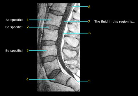 Radiographic Anatomy Abdomen Image 6 Diagram Quizlet