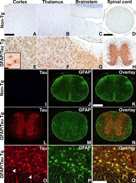 Transgenic Mouse Model Of Tau Pathology In Astrocytes Leading To