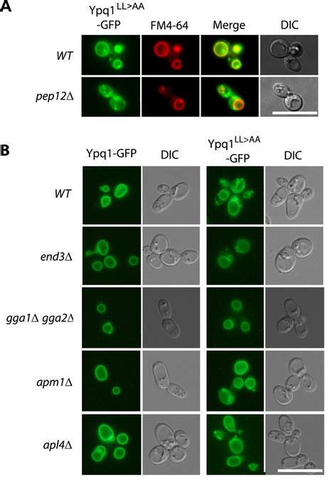 An Acidic Dileucine Motif Promotes Ypq Sorting To The Alp Pathway