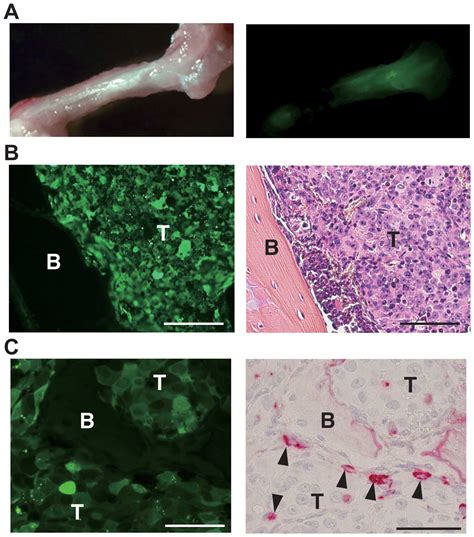 Establishment And Evaluation Of A New Highly Metastatic Tumor Cell Line