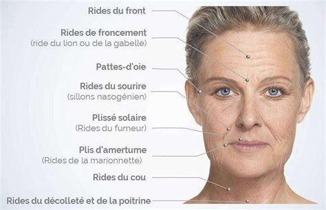 Les Rides Du Visage Solutions Pour Rajeunir Sans Chirurgie