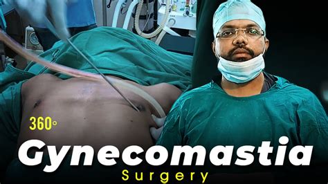 Gynecomastia Surgery Chest Fat Transformation Chest Fat Workout