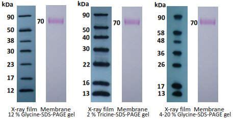 Bio rad western blot ladder - ptmumu