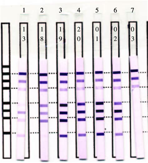 Syphilis Immunoblot Innolia Strips To Confirmed Positive