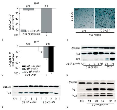 P Accumulation Induced By Irradiation Western Blotting Of P And