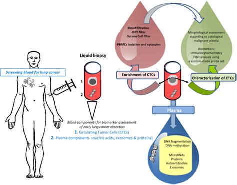 Liquid Biopsy For Lung Cancer Screening Usefulness Of Circulating