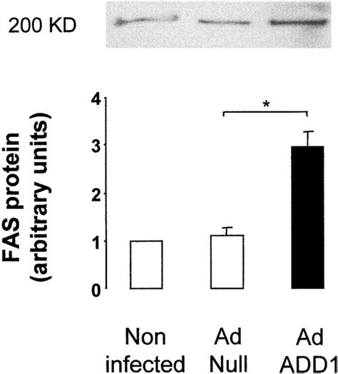 ADD 1 SREBP 1 Is A Major Determinant Of Tissue Differential Lipogenic