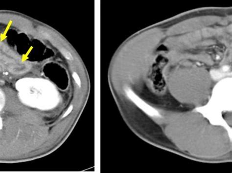 Trauma Radiology Cases