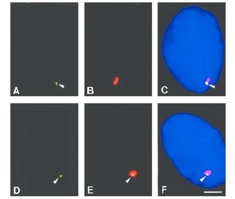 Simultaneous Fluoresence In Situ Hybridization Detection Of Hcmv Ie Dna